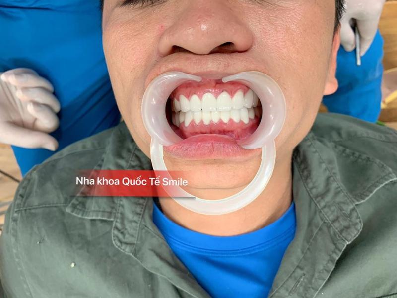 Nha khoa quốc tế Smile
