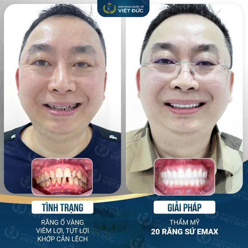 Nha khoa quốc tế Việt Đức