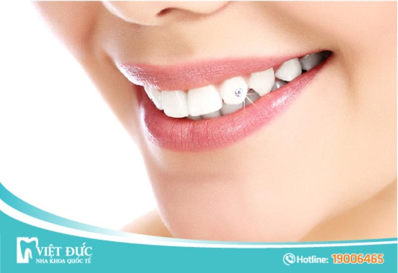 Khách hàng của nha khoa quốc tế Việt Đức