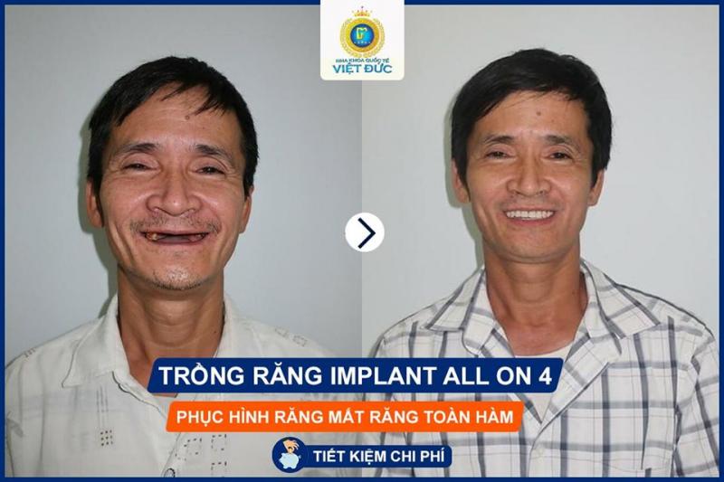 Nha khoa Quốc tế Việt Đức