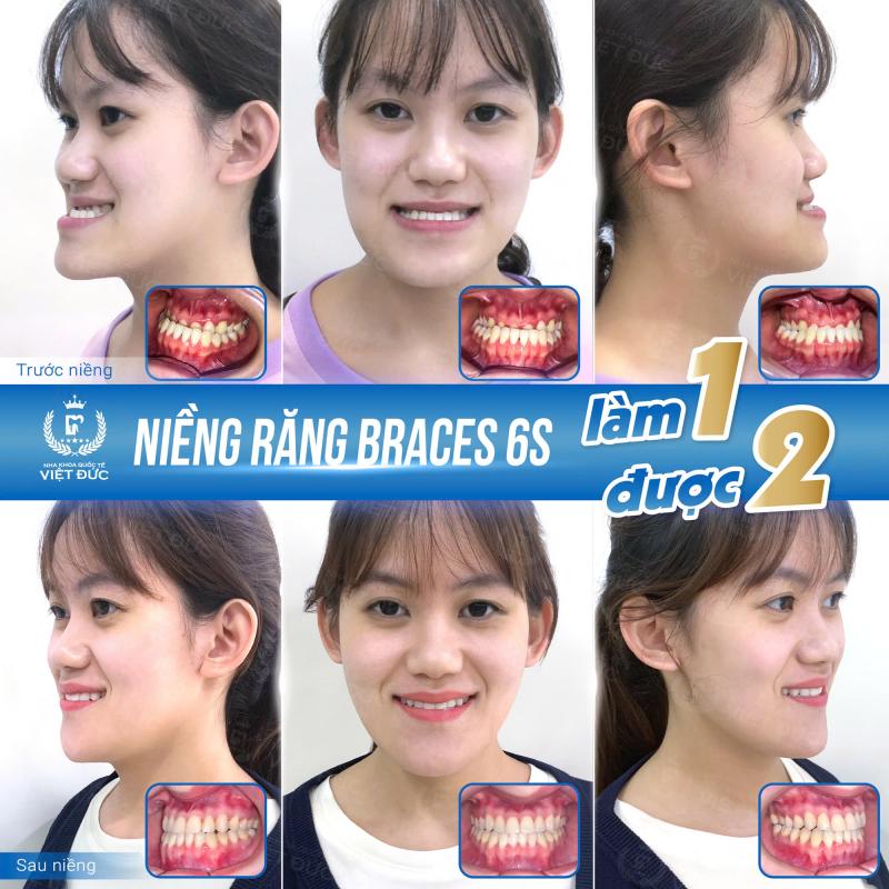 Nha khoa Quốc tế Việt Đức (thành lập năm 2005 - 20 năm hoạt động)