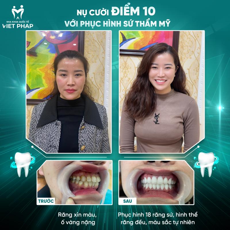 Phòng Khám Nha Khoa Quốc Tế Việt Pháp
