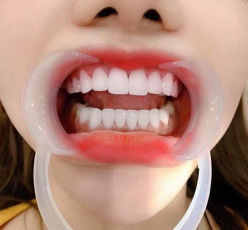 Nha Khoa Quốc Tế Việt Smile