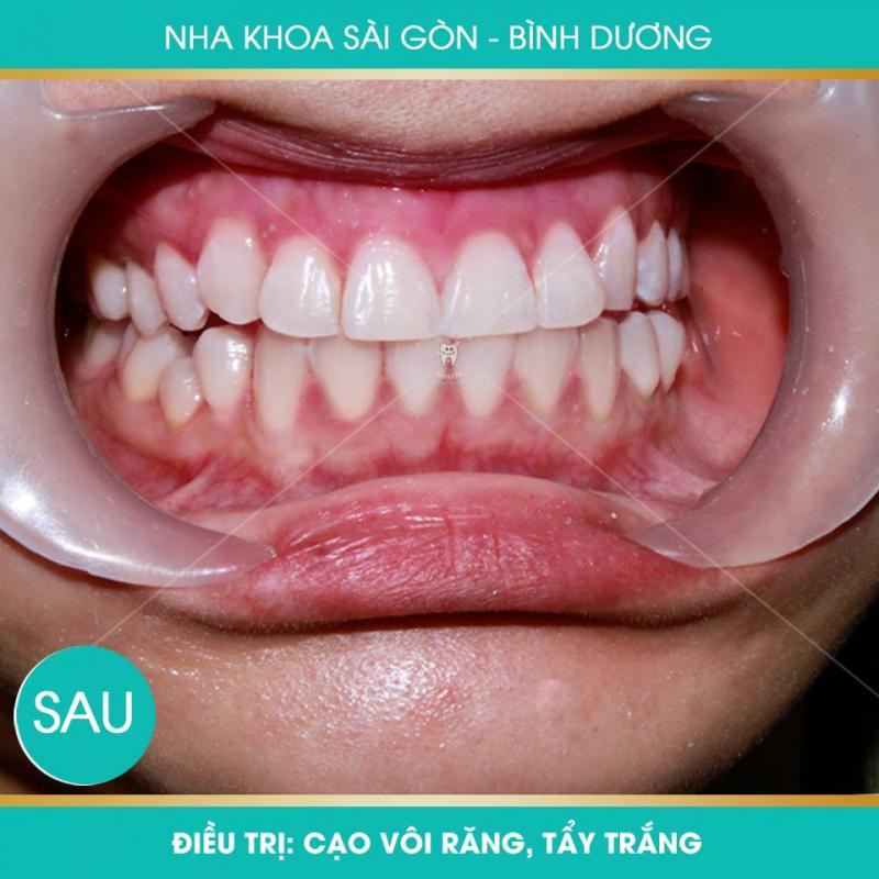 Nha khoa Sài Gòn Bình Dương