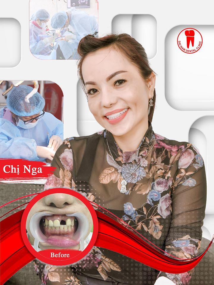 Nha Khoa Sài Gòn - Phan Thiết