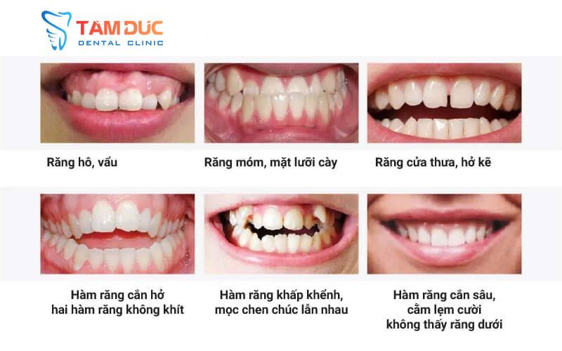 Nha Khoa Tâm Đức