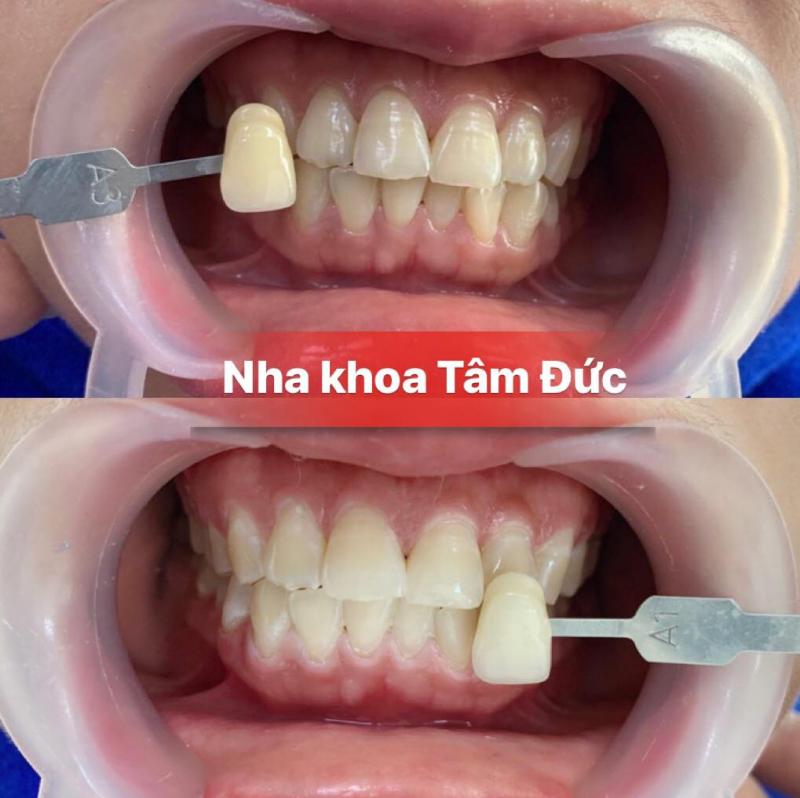 Nha Khoa Tâm Đức