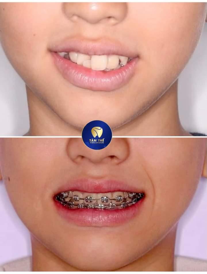 Nha Khoa Tâm Thế Đà Lạt