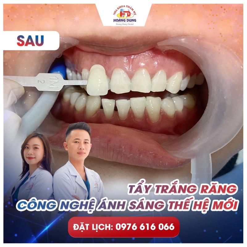 Nha khoa Thẩm mỹ Hoàng Dung