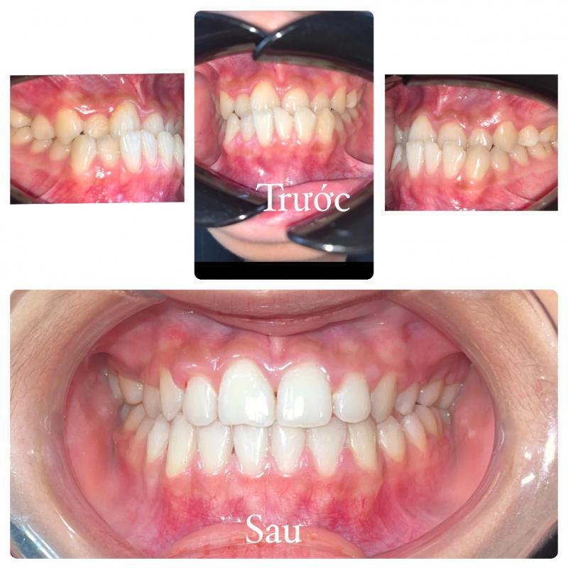 Nha khoa Thẩm mỹ Hồng Đức