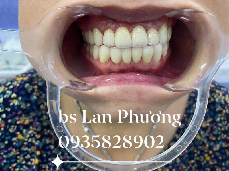 Nha khoa thẩm mỹ Lan Phương