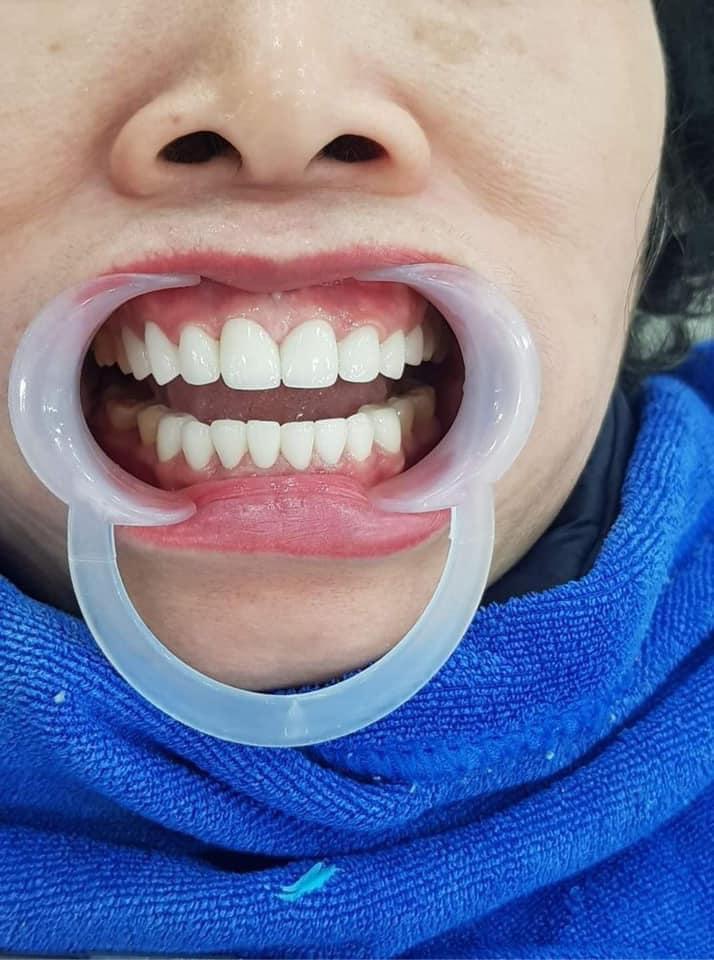 Nha khoa thẩm mỹ nice smile