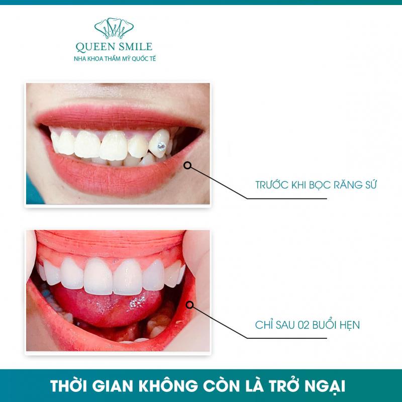 Nha khoa thẩm mỹ Queen Smile