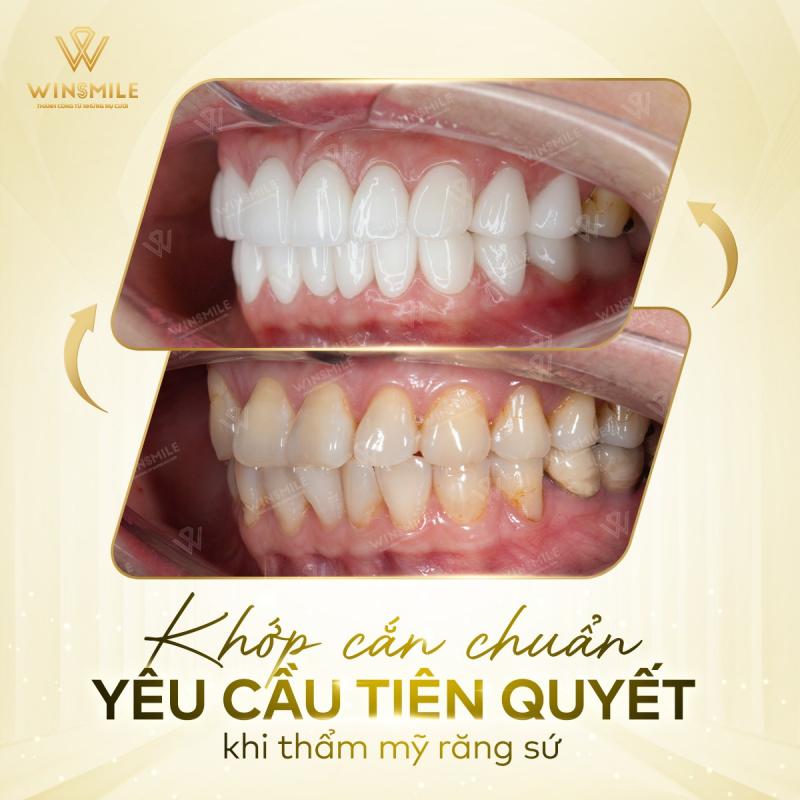 Win Smile