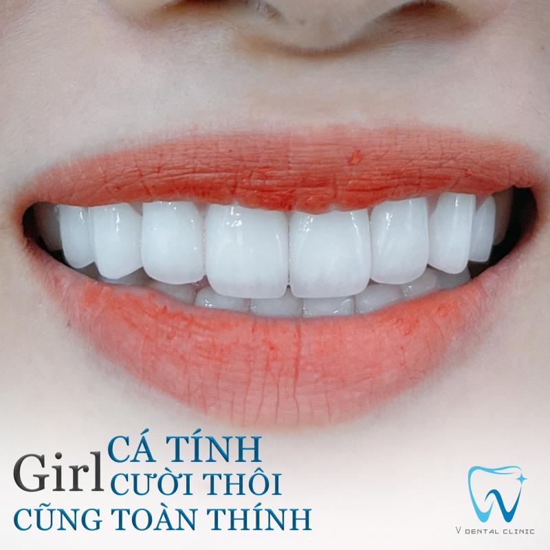 Nha Khoa Thẩm Mỹ V - V Dental Clinic