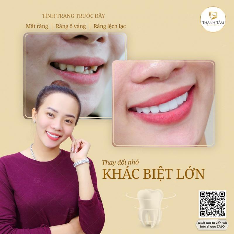 Nha khoa Thanh Tâm