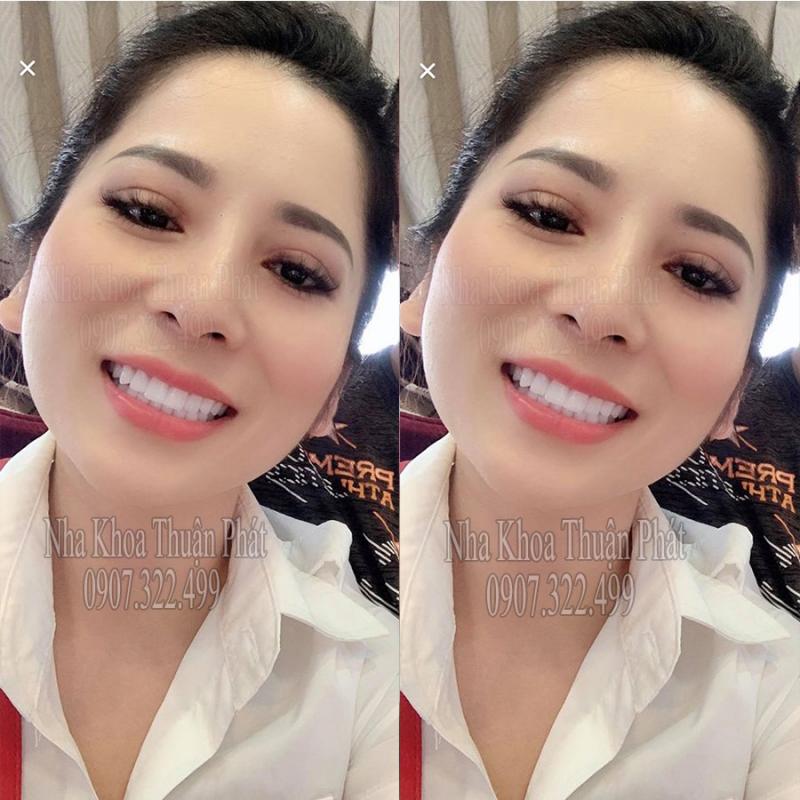 Nha Khoa Thuận Phát