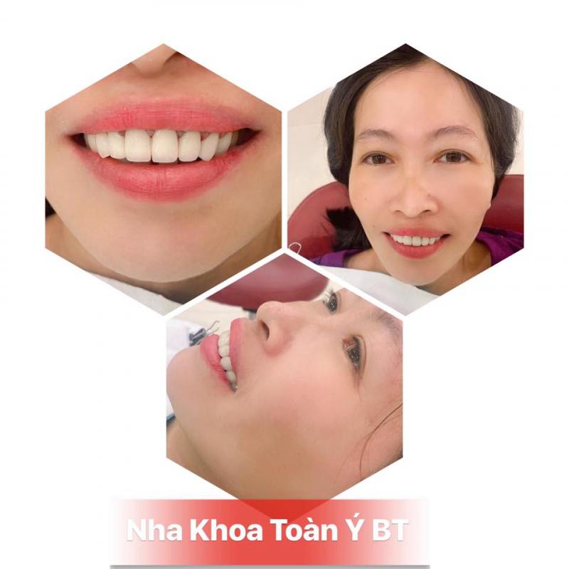 Nha khoa Toàn Ý