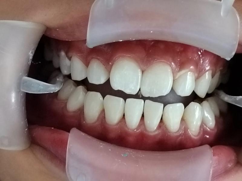 Nha Khoa Trần Gia Smile
