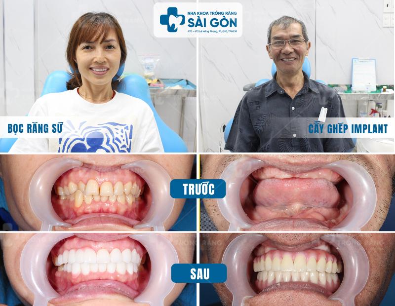 Nha khoa Trồng Răng Sài Gòn