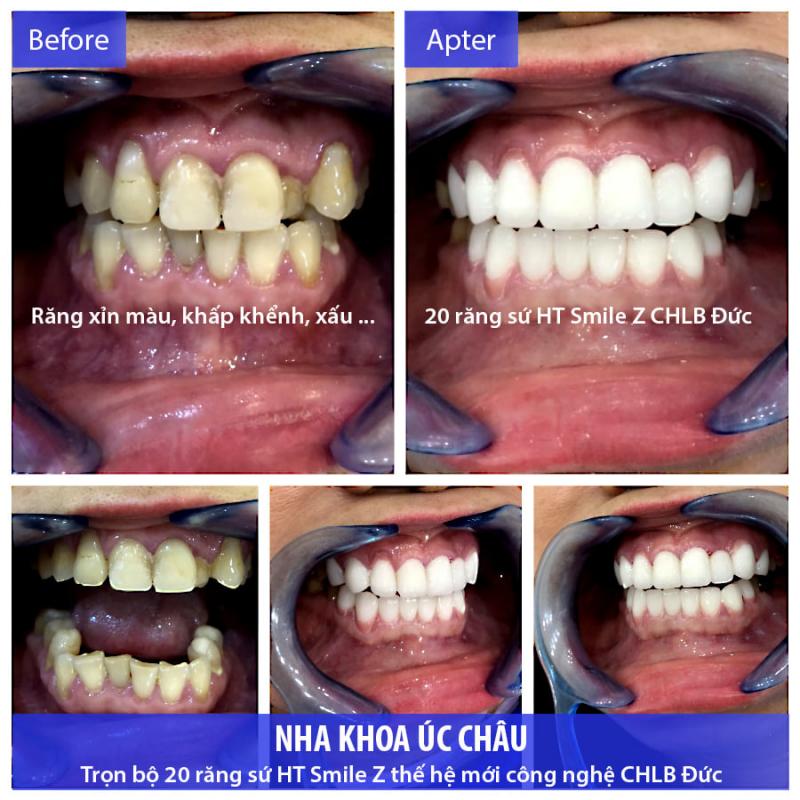 Nha khoa Úc Châu