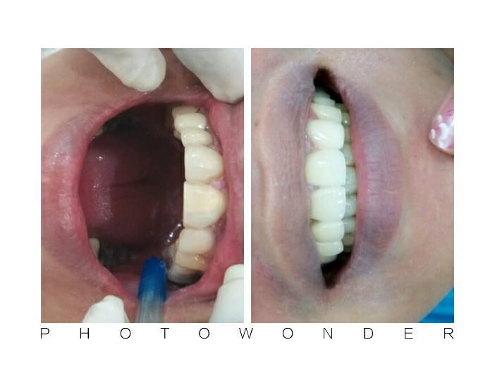 Nha khoa Việt Nha Bình Dương