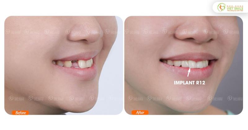 Nha khoa VIET SMILE