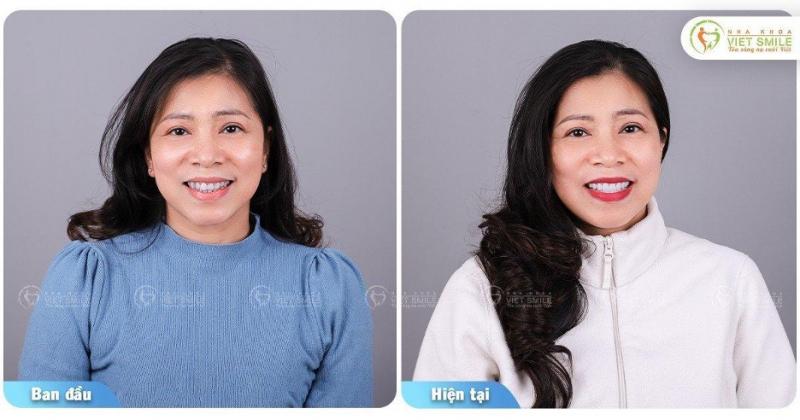 Nha khoa VIET SMILE