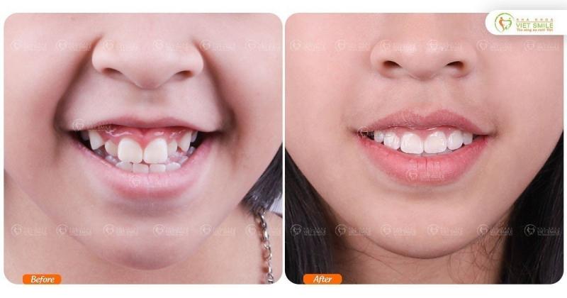 Nha Khoa VIET SMILE