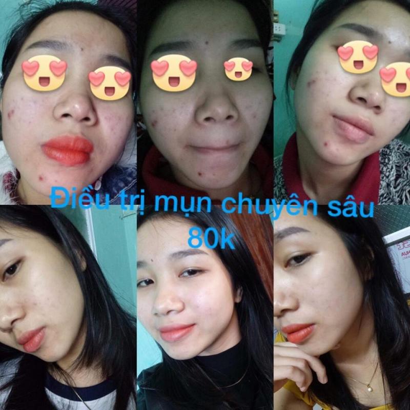 Nhi Spa