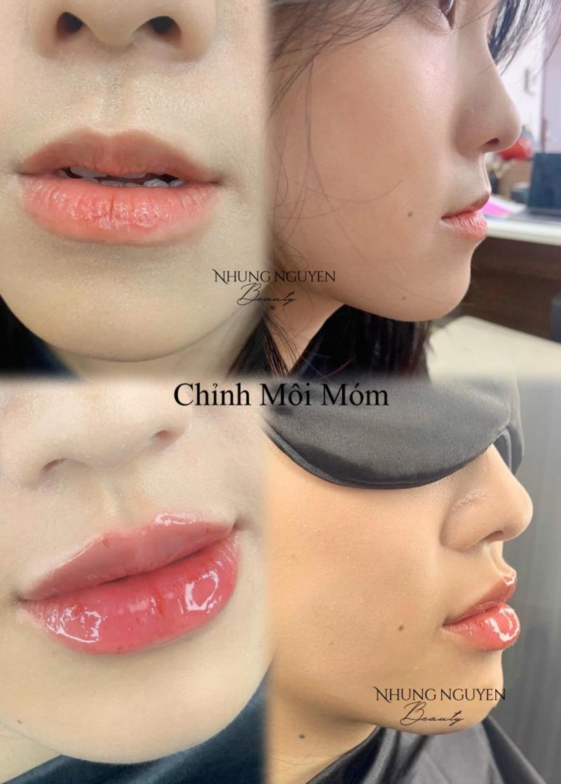 Nhung Nguyen Beauty Center