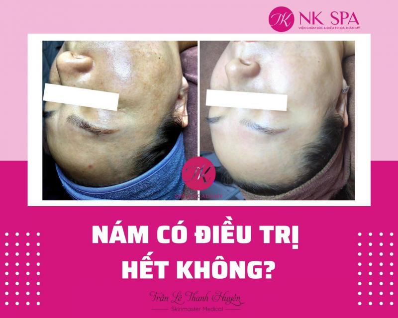 NK Spa & Academy