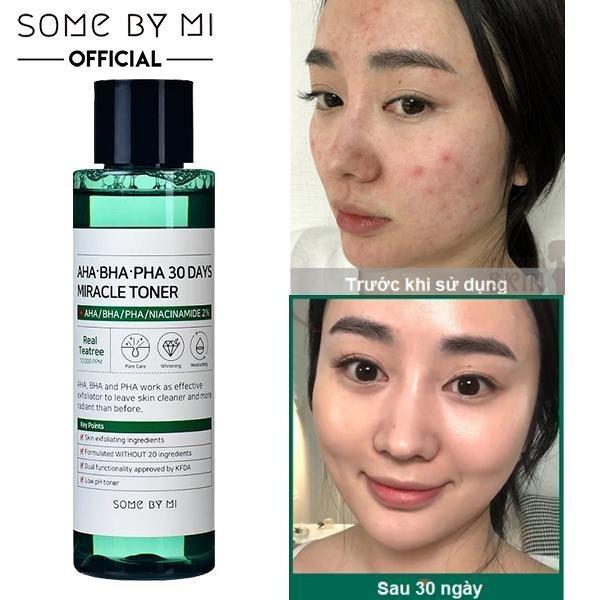 Nước hoa hồng ngừa mụn Some By Mi Aha-Bha-Pha 30 Days Miracle Toner