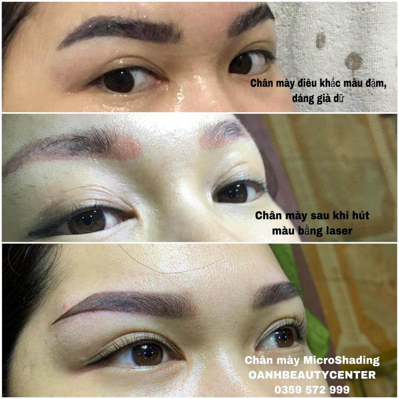 Thẩm mỹ Oanh Beauty Center