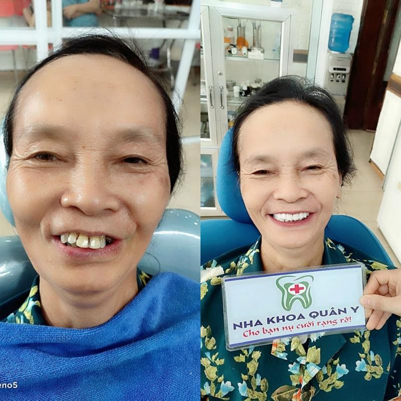 Phòng Khám Nha Khoa Quân Y