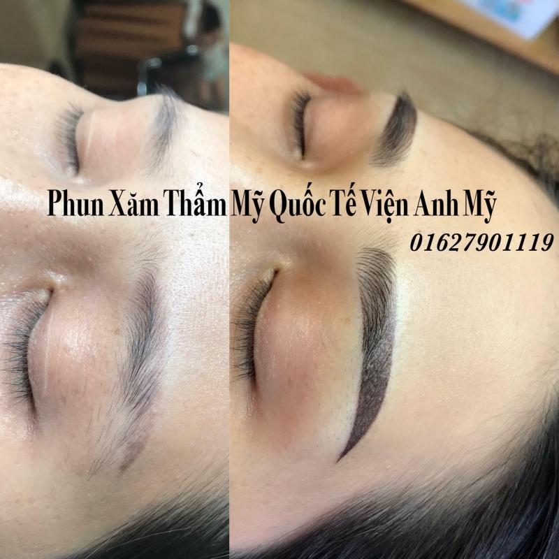 Phun xăm Thẩm mỹ Quốc Tế Viện Anh Mỹ