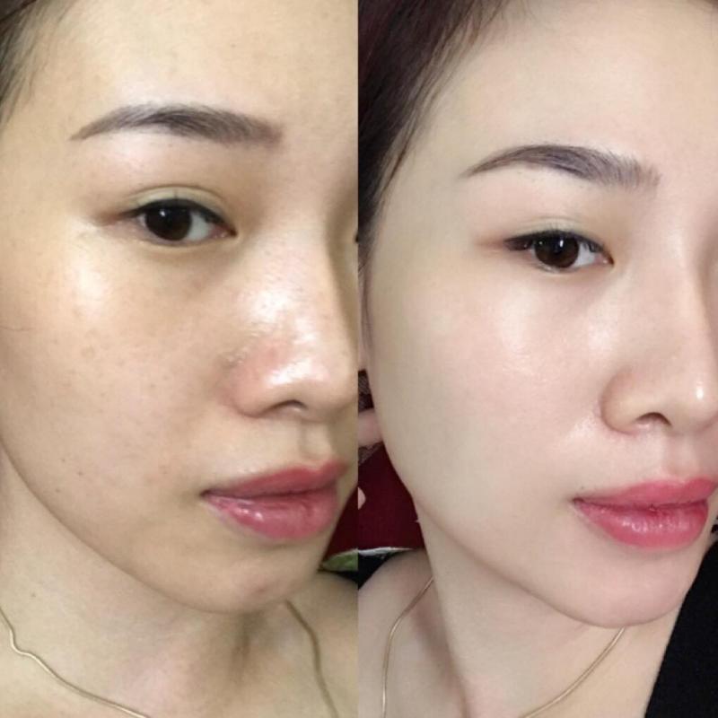 Phương Huyền Anh Spa