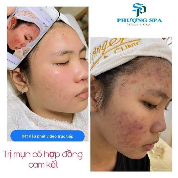 Phượng Spa