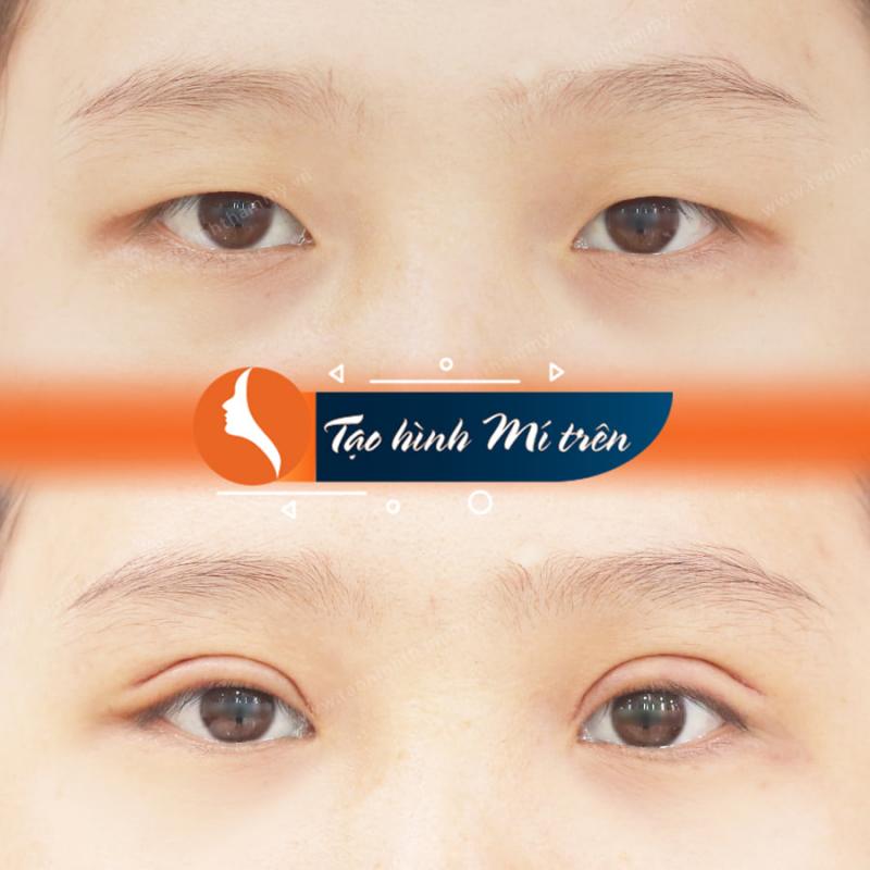 ﻿﻿﻿PK CK Phẫu Thuật Thẩm Mỹ TS. BS.Nguyễn Thành Nhân