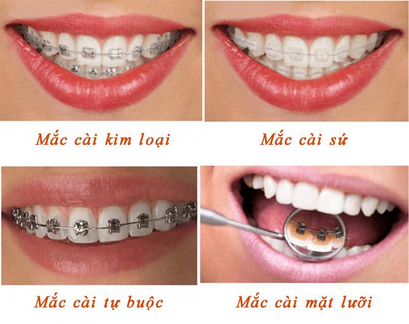 Răng hàm mặt Thái Thượng Hoàng