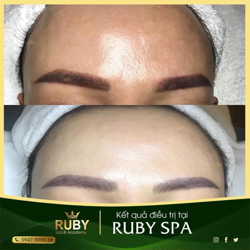Ruby Spa