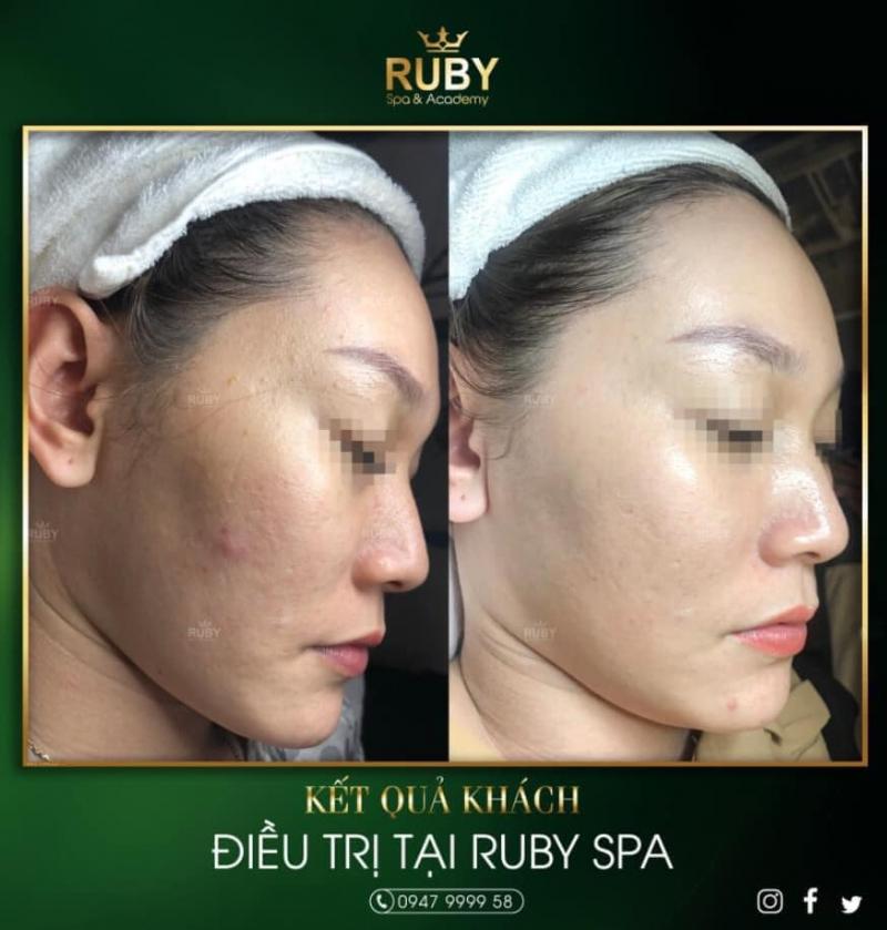 Ruby Spa