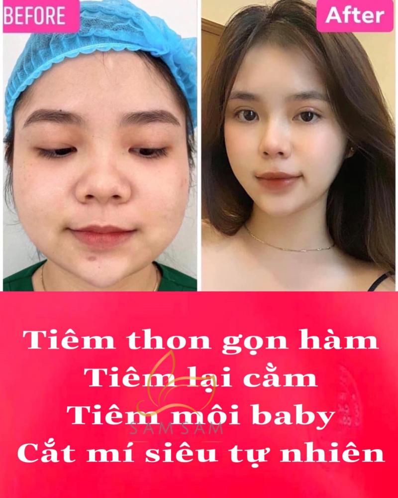 Sam Sam Beauty - Viện chăm sóc da chuyên điều trị mụn, nám, sẹo rổ.