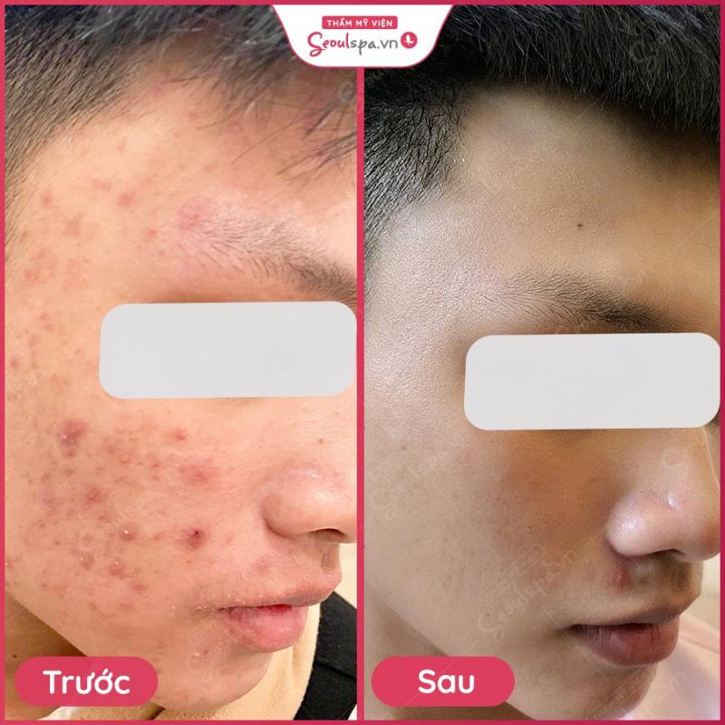 SeoulSpa.Vn Tam Kỳ - Quảng Nam