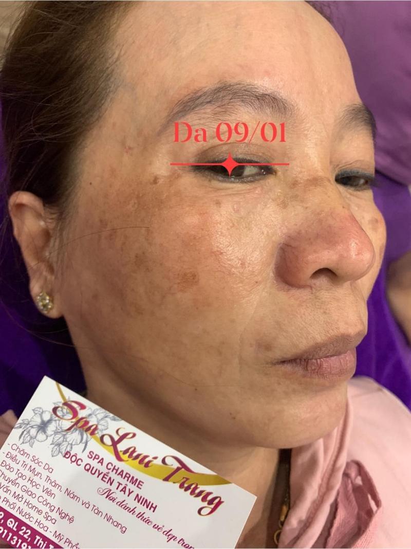 Spa Lani Trang