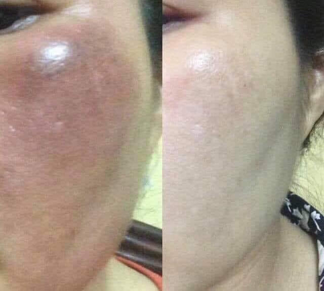 Spa Nét Huế
