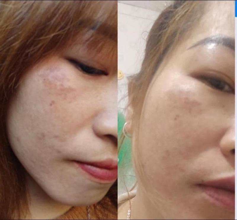 Spa Nét Huế