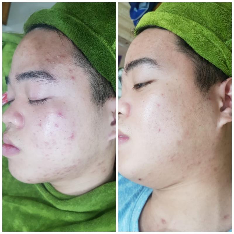 Spa Thùy Dương