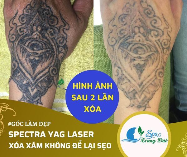 Spa Trang Đài