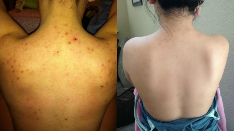 Bệnh viện Da liễu Cần Thơ